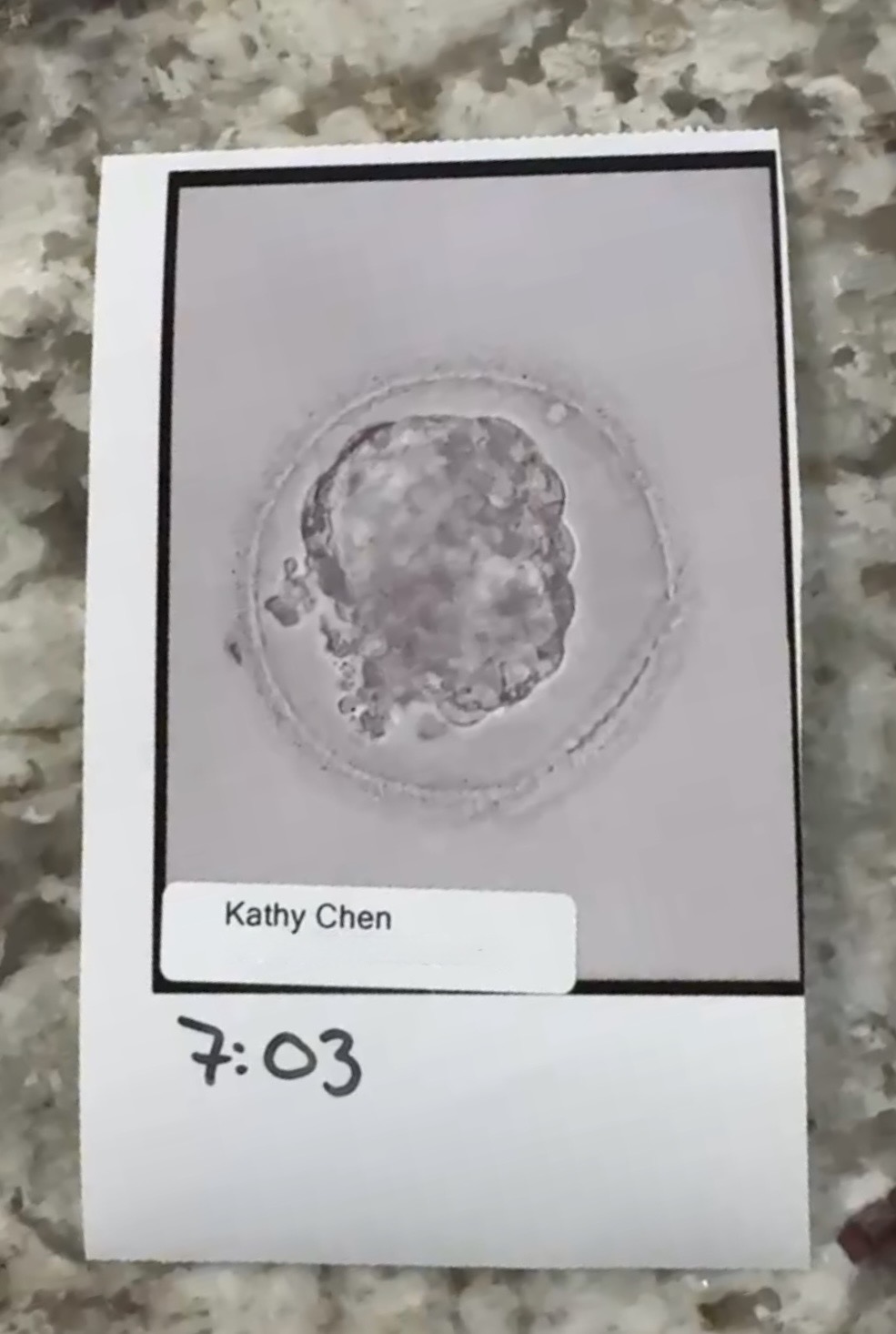 IVF: A Hundred Small Waiting Rooms